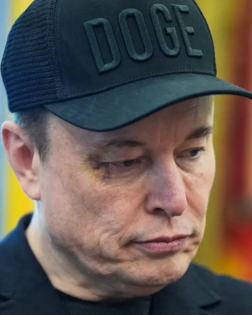 Elon Musk sorprende con un ojo morado en su despedida de la Casa Blanca